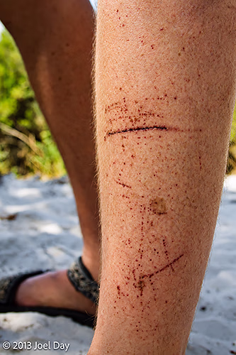 Aftermath of trekking through 6kms of scratchy bush and hungry march flies